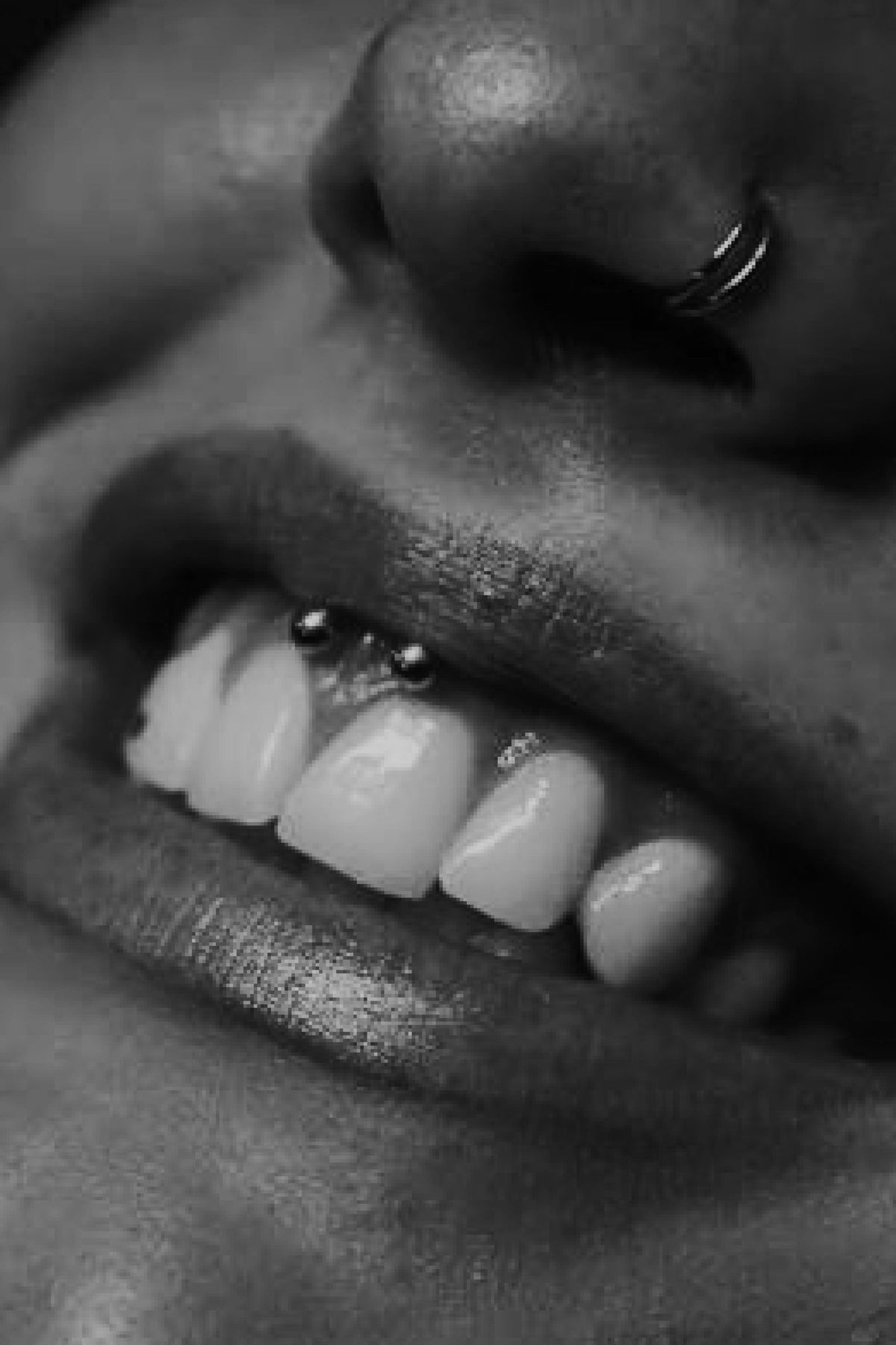 Buccal