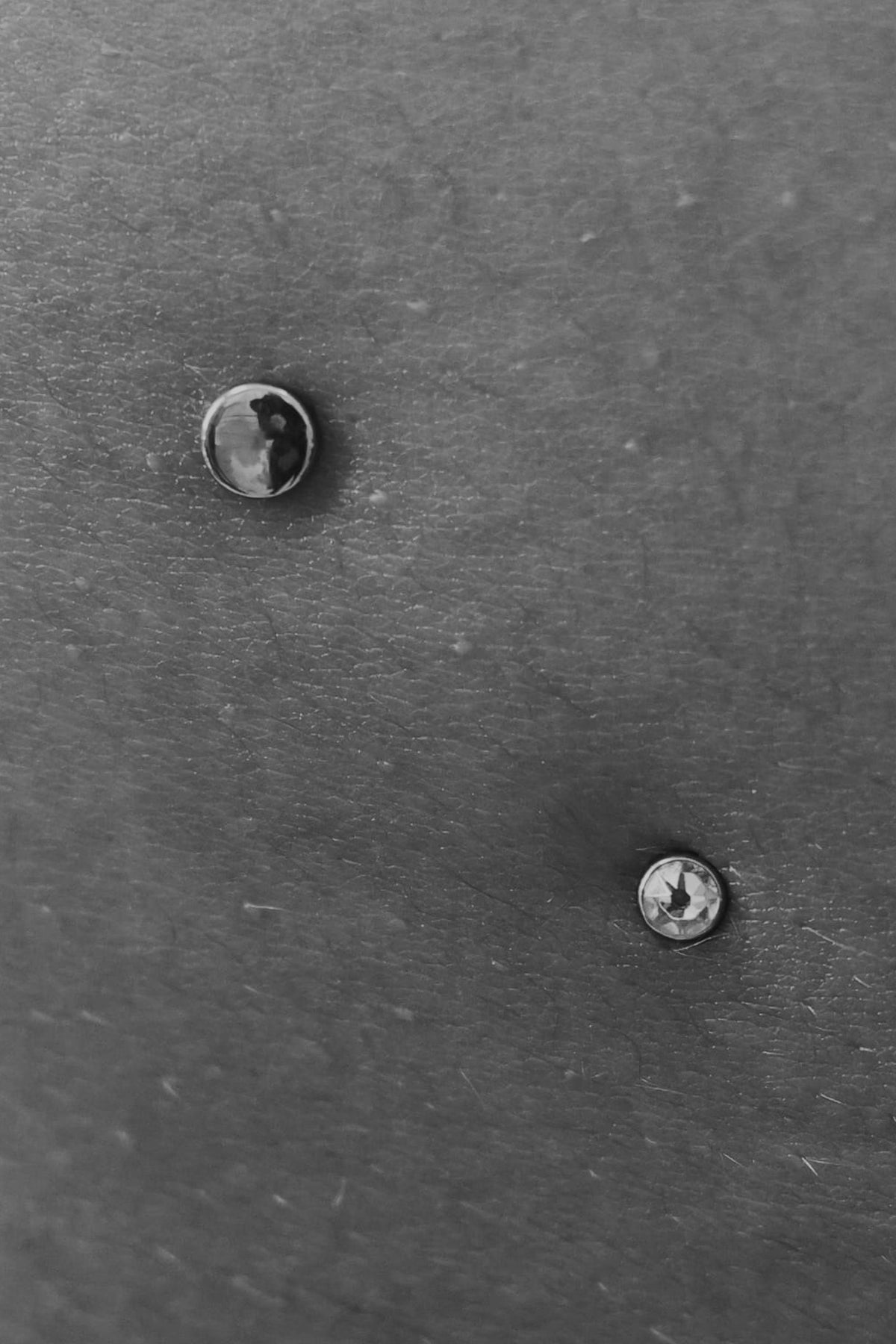 Dermal / Surface