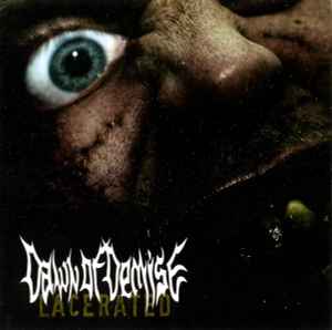 Dawn Of Demise – Lacerated